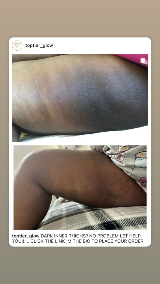 BRIGHTENING INNER THIGH CREAM